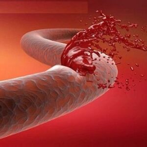 پاورپوینت درباره خونریزی ها